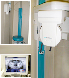 デジタルレントゲン