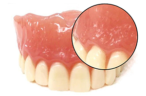 リアルレジン床義歯
