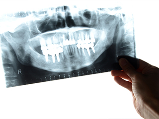 口腔外科のイメージ画像